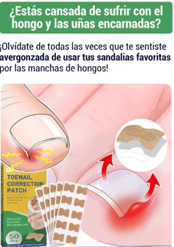 🦶 Parches para Uñas Encarnadas – Alivio y Corrección Sin Dolor! ✨👣-Pide Y Paga En Casa + Envío Gratis.